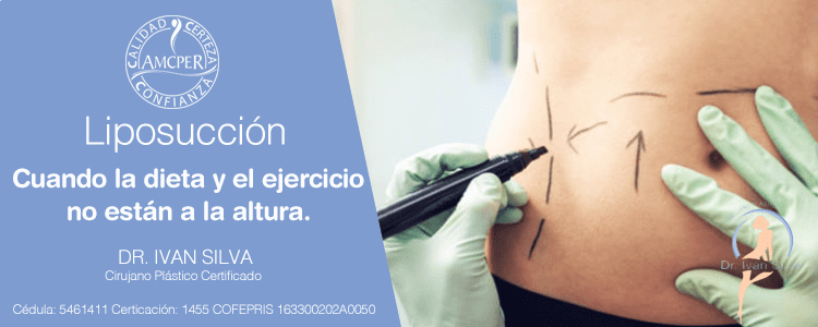 Liposucción con un cirujano plástico en cdmx