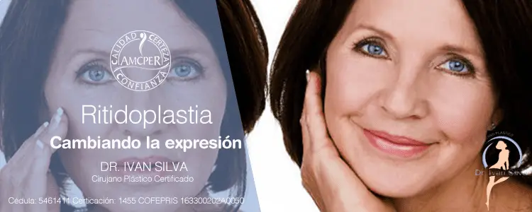 Ritidoplastia en cdmx